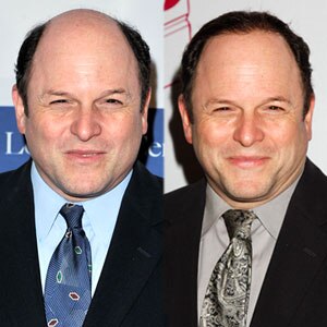 Jason Alexander