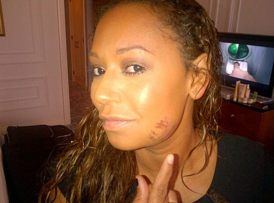 Mel B,
