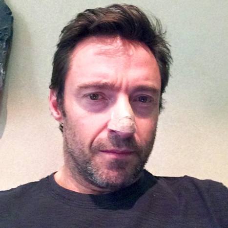 Hugh Jackman Hugh Jackman
