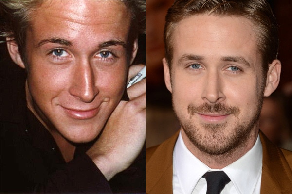 Ryan Gosling plástica nariz antes depois Ryan Gosling plástica nariz antes depois