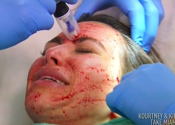 Kim Kardashian, sangre Kim Kardashian, sangre