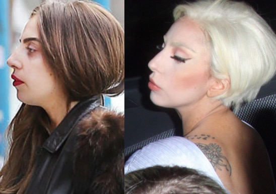 Lady Gaga before and after Lady Gaga before and after