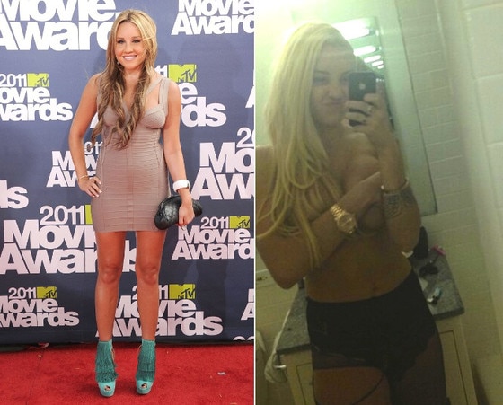 Amanda Bynes antes e depois silicone Amanda Bynes antes e depois silicone