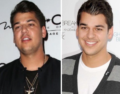 ROB KARDASHIAN ANTES E DEPOIS ROB KARDASHIAN ANTES E DEPOIS