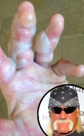 Hulk Hogan Hulk Hogan