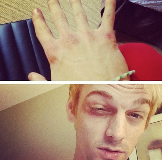 Aaron Carter Aaron Carter