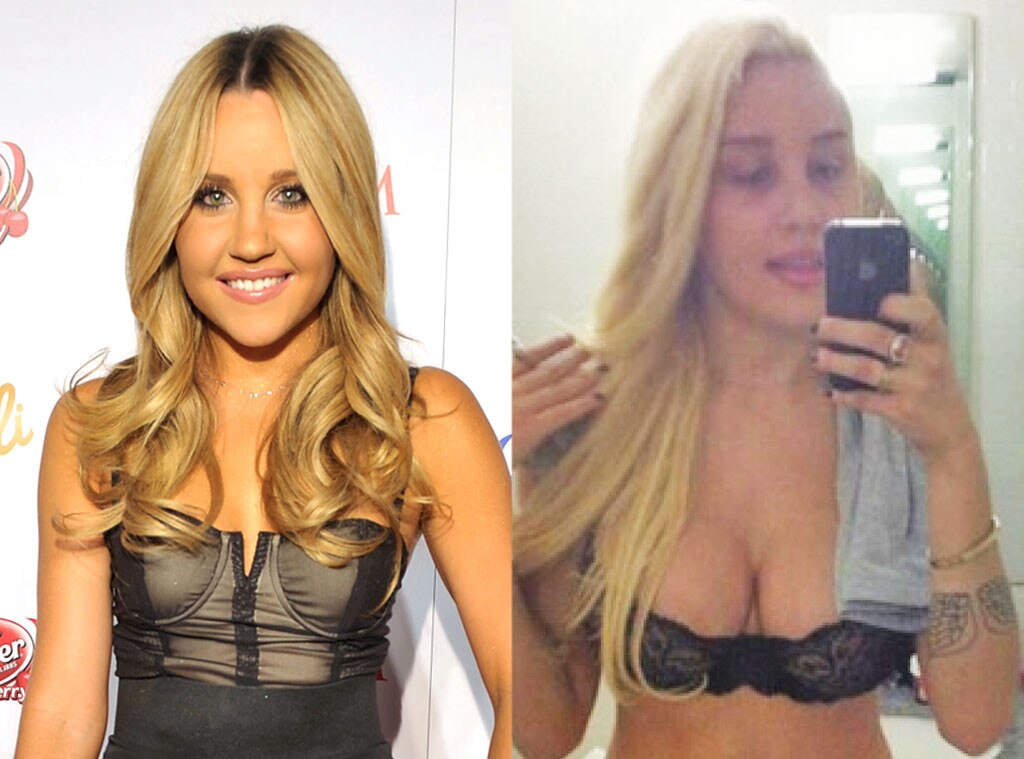 Plastic Surgery Before and After, Amanda Bynes Plastic Surgery Before and After, Amanda Bynes