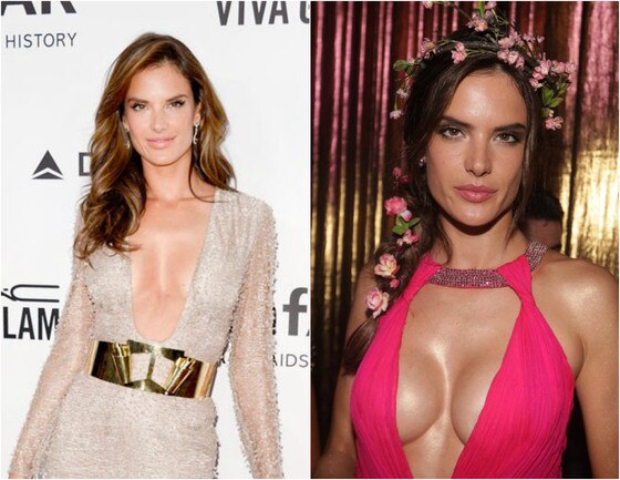Alessandra Ambrosio antes e depois do silicone Alessandra Ambrosio antes e depois do silicone
