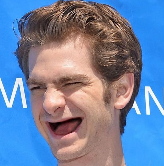 Os famosos sem dentes Os famosos sem dentes