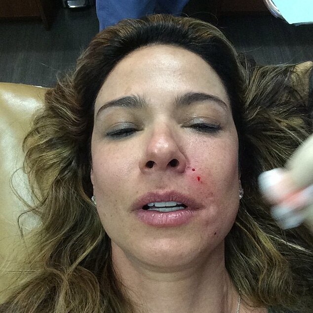 Luciana Gimenez reinjeta sangue para preencher rugas Luciana Gimenez reinjeta sangue para preencher rugas