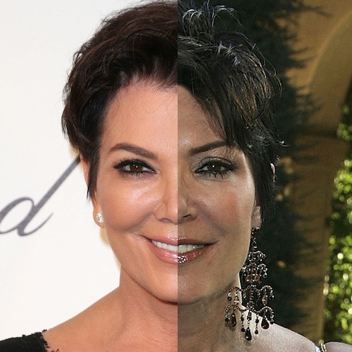 Mudança no rosto das Kardashians Mudança no rosto das Kardashians