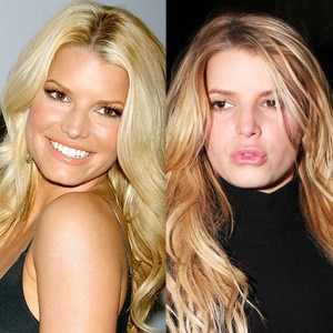 Jessica Simpson, Plastic Surgery Jessica Simpson, Plastic Surgery