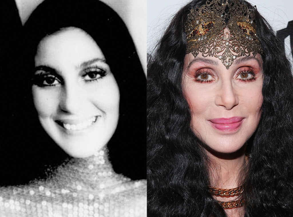 Cher From Better Or Worse Celebs Who Have Had Plastic Surgery