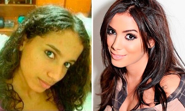 As famosas com plástica no nariz As famosas com plástica no nariz