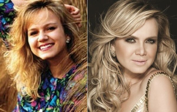 As famosas com plástica no nariz As famosas com plástica no nariz