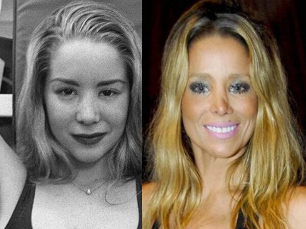 As famosas com plástica no nariz As famosas com plástica no nariz