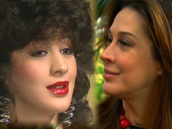 As famosas com plástica no nariz As famosas com plástica no nariz