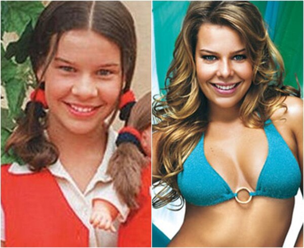 As famosas com plástica no nariz As famosas com plástica no nariz