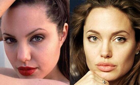 Angelina Jolie Cirurgia Plastica Angelina Jolie Cirurgia Plastica