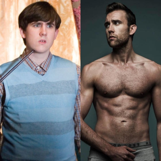 Matthew Lewis, antes e depois Matthew Lewis, antes e depois