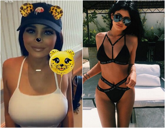 Kylie Jenner, antes e depois Kylie Jenner, antes e depois