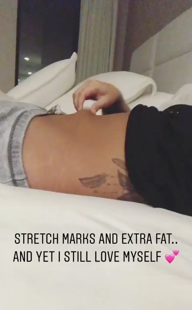 Demi Lovato, Body Positivity, Instagram Stories