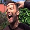 Joel McHale with bleeding head