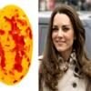 Kate Middleton, Jelly Bean