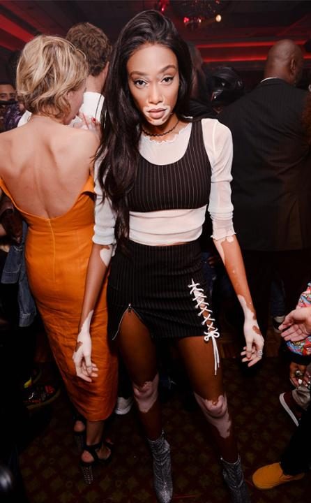 Winnie Harlow Winnie Harlow
