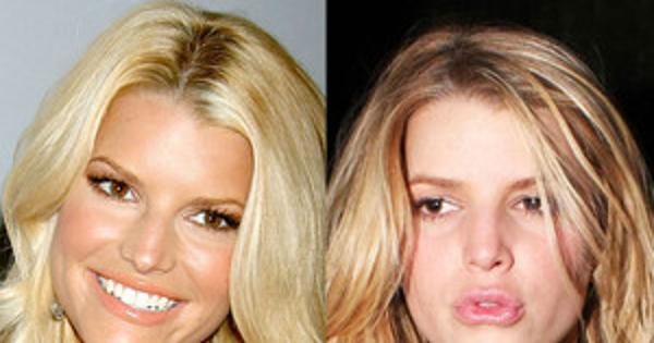 Jessica Simpson, Tori Spelling and More Regret Getting Plastic Surgery