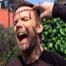 Joel McHale with bleeding head