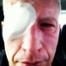 Anderson Cooper Eyepatch