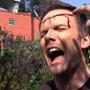 Joel McHale with bleeding head