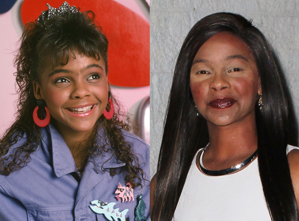 Lark Voorhies, Saved by the Bell, Plastic Surgery