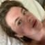 Ireland Baldwin Shares Photo of Gruesome Injury From Babysitting for Just “45 Minutes”